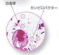 写真：カンピロバクター。白血球とカンピロバクターが見える。